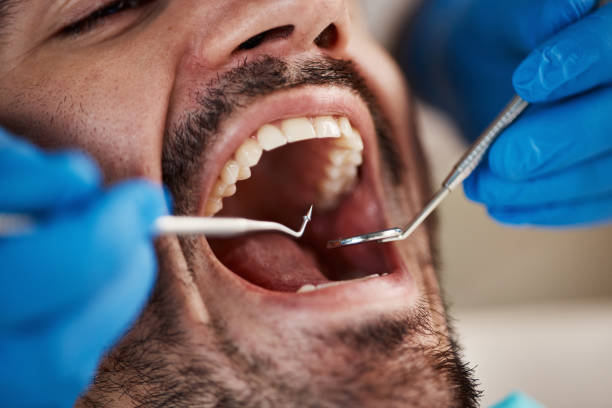 Best Broken or Cracked Tooth Emergency Dentist in Standish, MI