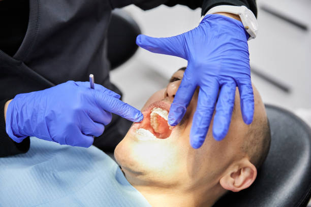 Best Emergency Dentist for Lost Fillings or Crowns in Standish, MI