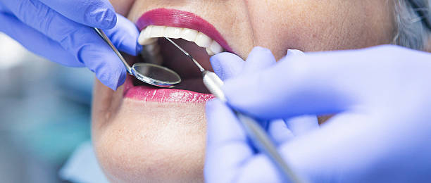 Best Emergency Dentist for Knocked-Out Tooth in Standish, MI